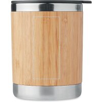 Area marcaje Láser frontal